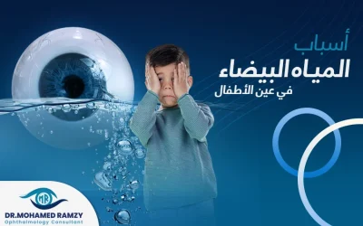 اسباب المياه البيضاء في العين عند الأطفال ومخاطر تأخير علاجها