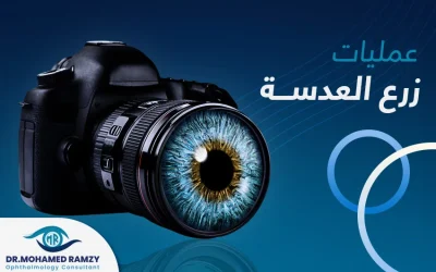 عمليات زرع العدسة | أفضل علاج لضعف النظر