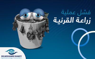 اسباب فشل عملية زراعة القرنية؟