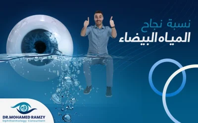 كم نسبة نجاح عملية المياه البيضاء؟ وهل هي آمنة؟
