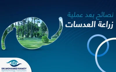 نصائح بعد عملية زراعة العدسات للتعافي سريعًا