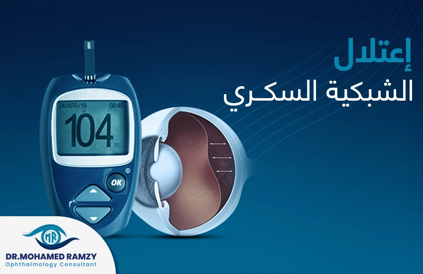 اعتلال الشبكية السكري
