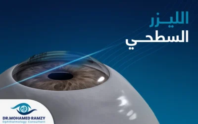 ما هو الليزر السطحي؟