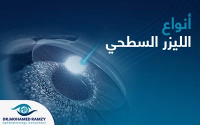 ‫ما أنواع الليزر السطحي (PRK)؟‬ ‫‬