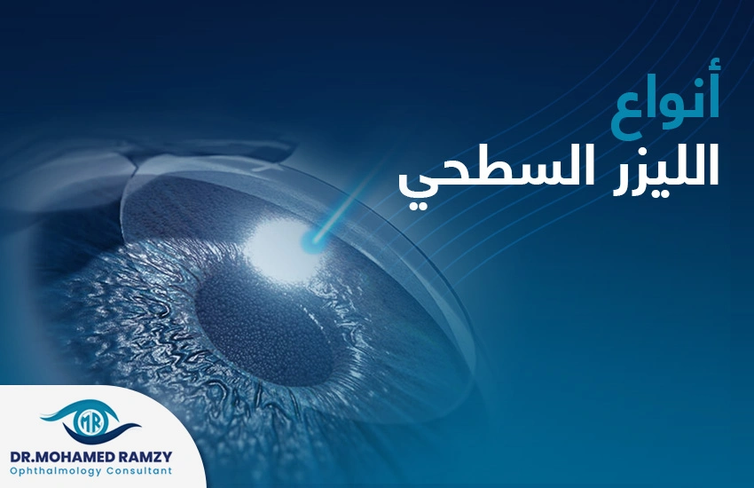 انواع الليزر السطحي