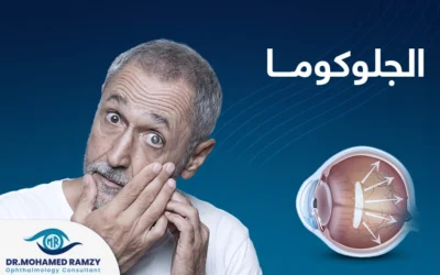 الجلوكوما: أخطر أمراض العيون وأكثرها انتشارًا