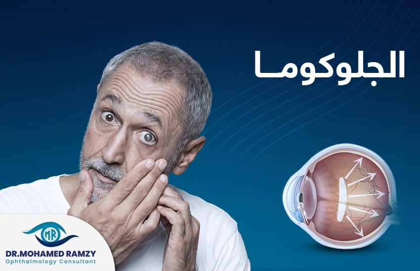 الجلكوما الجلوكوما
