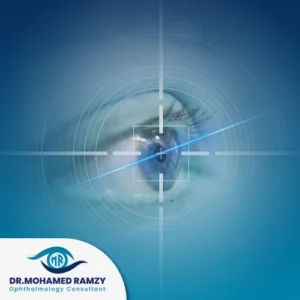 عيوب الليزر السطحي