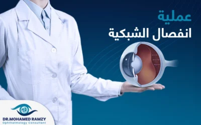 تعرف إلى تفاصيل عملية انفصال الشبكية وأعراض ما بعد إجرائها