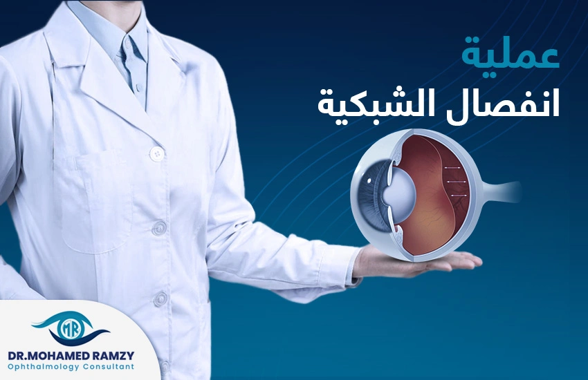 عملية انفصال الشبكية عملية انفصال الشبكية