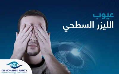 عيوب الليزر السطحي: نقاط هامة قبل اتخاذ القرار